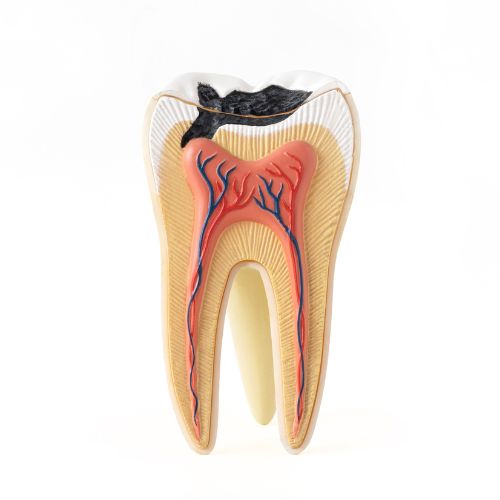 carie dentaire dentiste belleville sur meuse