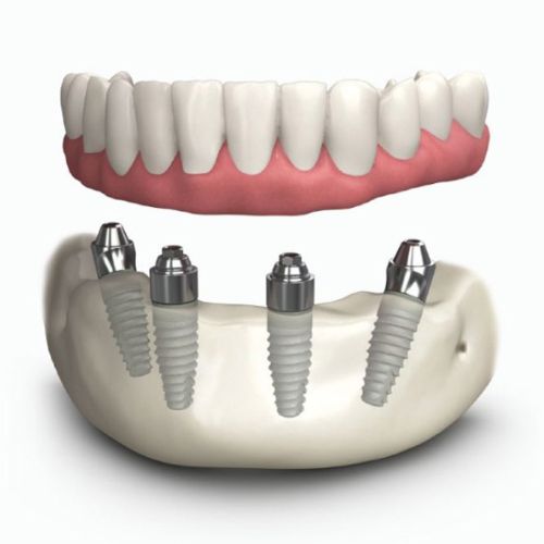 Prothèses dentaires dentiste Belleville sur Meuse